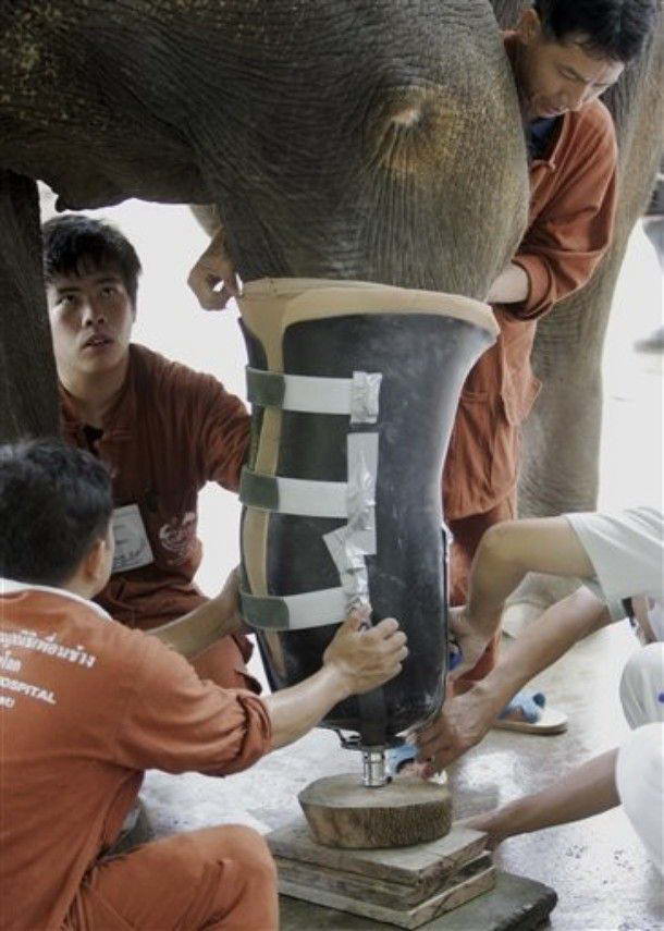 новый умный протез получила и её 48-ми летняя мамаша Мотола. Мотола подорвалась в 1999 году во время работы на лесозаготовках на границе Таиланда и Мьянмы (тогда Бирмы)