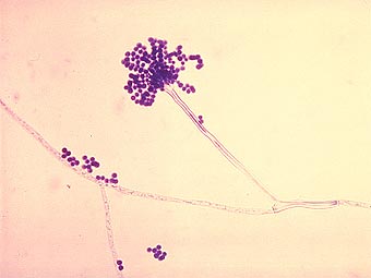 Плесневые грибы A. fumigatus оказались способны к сексу