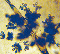 Ботритис пепельно-серый (Botrytis cinerea).