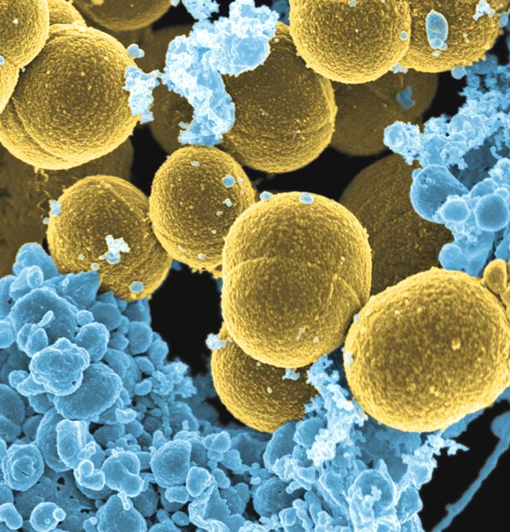  Лейкоциты (голубым цветом) атакуют бактерии Стафилококка золотистого, который является причиной возникновения широкого спектра болезней от угревой сыпи до пневмонии