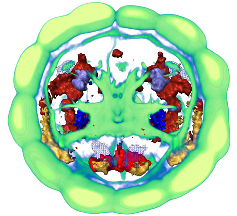 Виртуальное изображение мозга личинки червя, собранное по данным от 36 отдельных экземпляров. При помощи различных цветов на картинку мозга наложена активность отдельных генов (иллюстрации EMBL/R. Tomer).