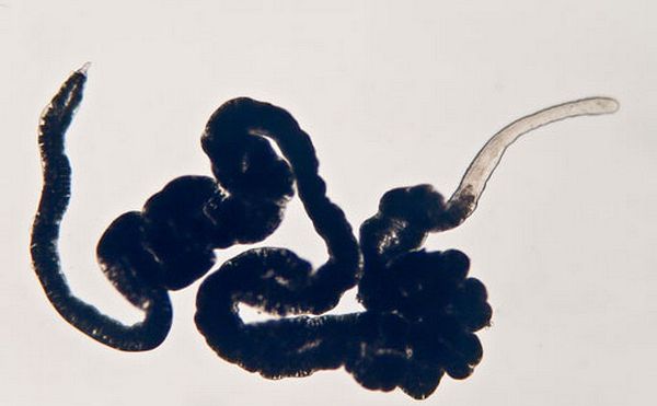 Paracatenula urania и живущие в нём бактерии представляют собой самый древний пример симбиоза подобного рода. (Фото авторов исследования.)