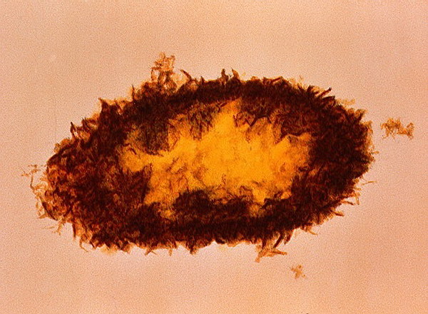 Ещё один необычный микроорганизм — бактерия Desulphovibrio sp. bacterium, поедающая серосодержащие токсические соединения 