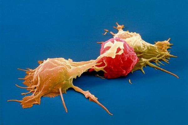 Природные Т клетки-киллеры атакуют раковую клетку.