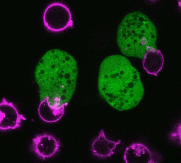 Амёба (светится зелёным светом) откусывает кусок от человеческой клетки (розовая) (фото Katherine Ralston). 