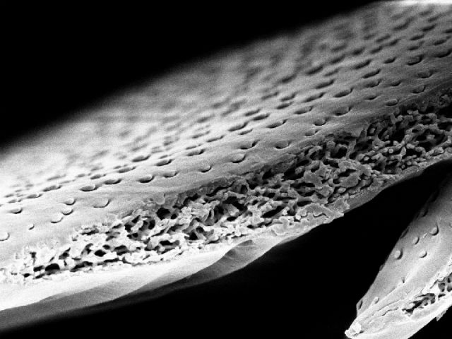 Покрытие панциря белого бриллиантового жука в разрезе (фото Lorenzo Cortese).