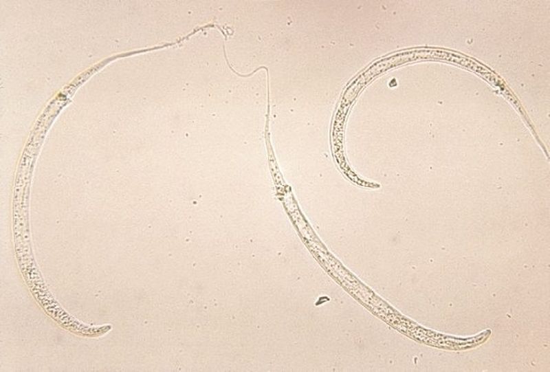 10 микроскопических монстров, обитающих в водоёмах