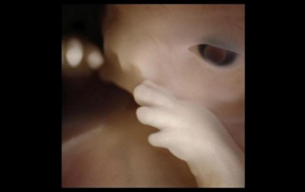 Фотопроект: От зачатия до рождения