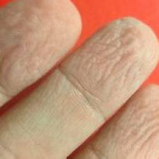 Почему кожа на пальцах морщится в воде