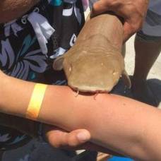 Американку привезли в больницу вместе с вцепившейся в ее руку акулой