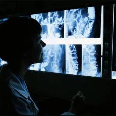Рентгеновские лучи - изобретение, перевернувшее мир