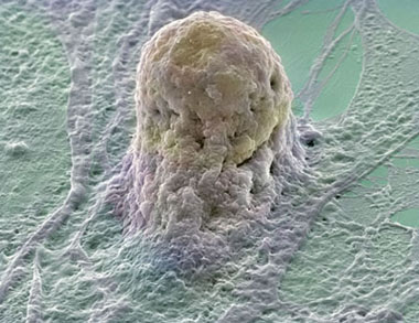 стволовые клетки человека