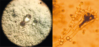 Пенициллиум оранжево-серый (Penicillium aurantiogriseum) 