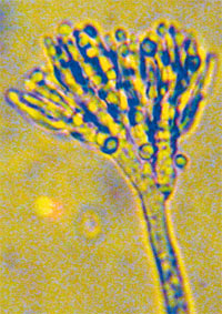 Пенициллум золотистый (Penicillium chrysogenum)
