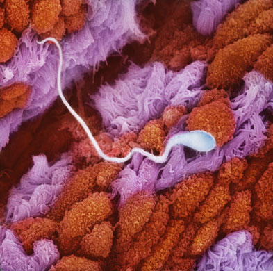 Сперматозоид в маточных трубах