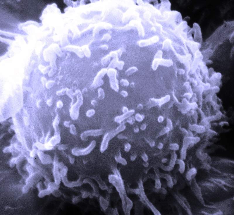 Фотография одного из лимфоцитов, сделанная с помощью электронного микроскопа
