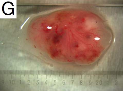 Тератома (опухоль, выращенная из клеток, перепрограммированных в стволовые) содержала все три зародышевых слоя (фото PNAS).