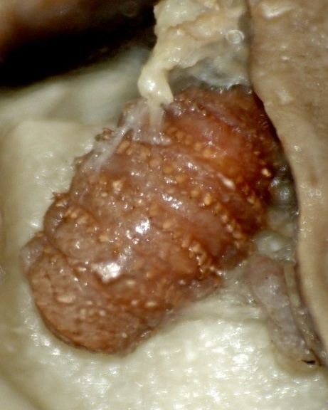 Личинка Gasterophilus intestinalis (larva)