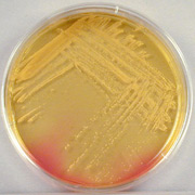 золотистый стафилококк (Staphylococcus aureus