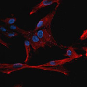 Вкусовые рецепторы лёгких под микроскопом (красные) и их ядра (синие) (фото University of Maryland School of Medicine).
