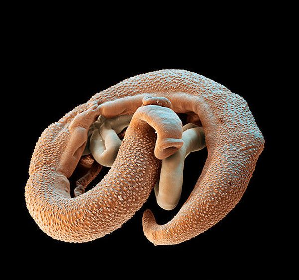 Паразитический червь шистосома определяет нашу эволюцию в больше степени, чем климат, пищевой рацион и даже бактерии.