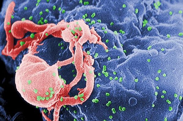 ВИЧ с точки зрения сканирующего электронного микроскопа
