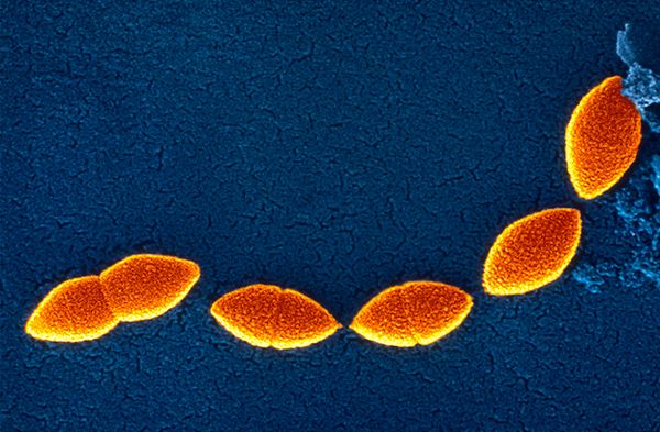 Streptococcus pneumonia — одна из бактерий, вызывающих воспаление носовых пазух. (Фото <noindex><a target=_blank href=http://www.flickr.com/photos/sanofi-pasteur/ _cke_saved_href=http://www.flickr.com/photos/sanofi-pasteur/ _cke_saved_href=http://www.flickr.com/photos/sanofi-pasteur/>Sanofi Pasteur</a></noindex>.)