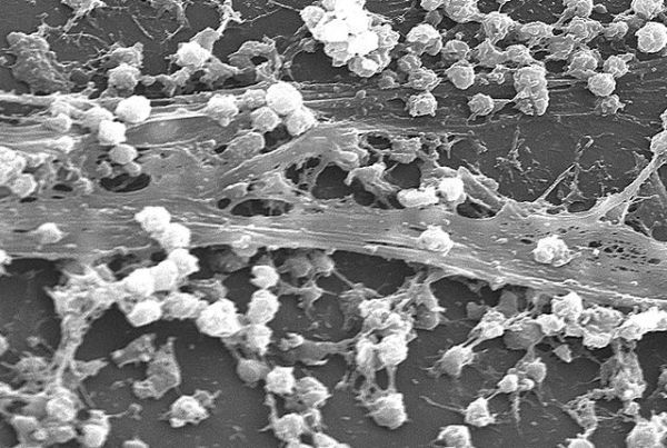 Хрестоматийный пример биоплёнки, образующейся в больничных условиях на катетере. В данном случае в её составе преобладает Staphylococcus aureus, самый массовый возбудитель внутрибольничных инфекций. (Фото Wikimedia Commons.)