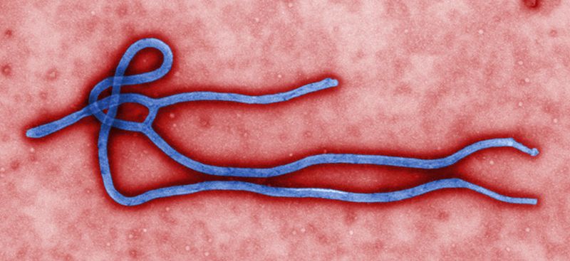 Микробиолог Синтия Голдсмит, сотрудница лаборатории Центра по контролю и профилактике заболеваний, с помощью просвечивающего электронного микроскопа воспроизвела ультраструктурную морфологию вируса Эбола