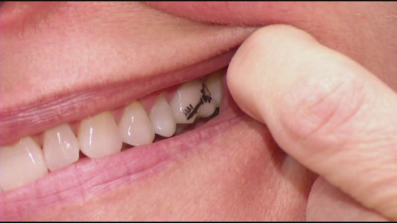 10 невероятных фактов о человеческих зубах