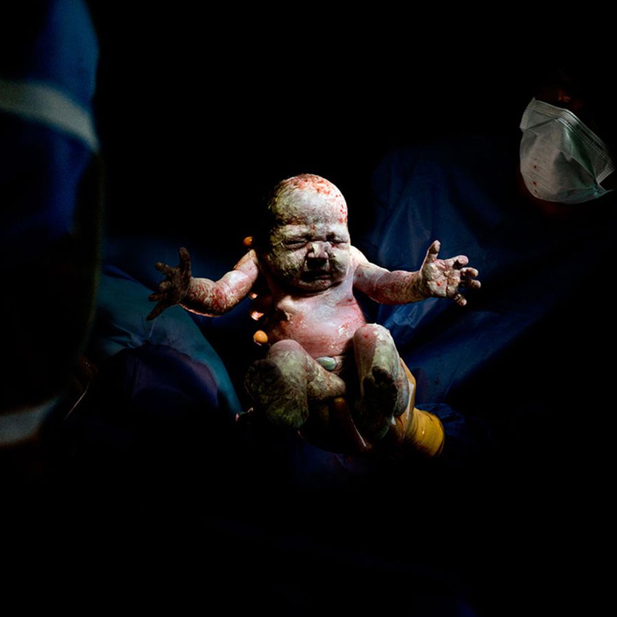 Фотографии младенцев сразу после рождения