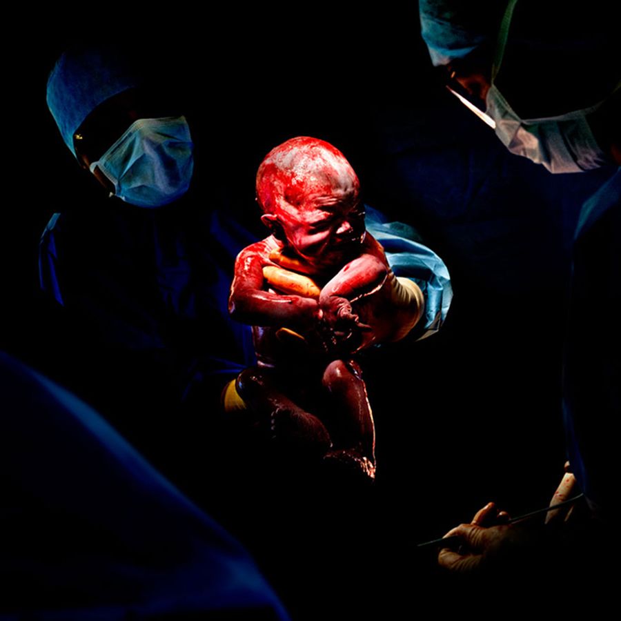 Фотографии младенцев сразу после рождения