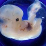 Почему эмбрион повторяет предыдущие этапы развития жизни