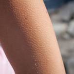 Почему у людей появляются "мурашки" на коже?