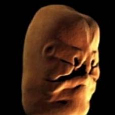 Впервые снято видео, демонстрирующее формирование лица в материнской утробе