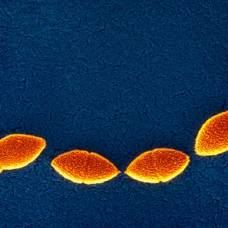 Морские бактерии помогут избавиться от синусита