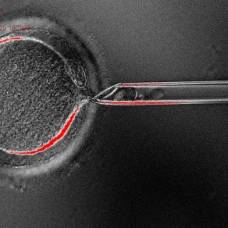 Клонированы эмбриональные стволовые клетки человека