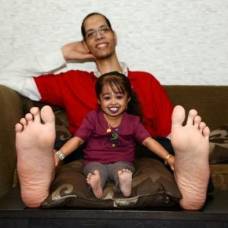 Самая маленькая женщина в мире и обладатель самый больших ступней