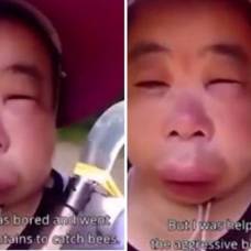 Китаянка попыталась стащить мед из улья и опухла