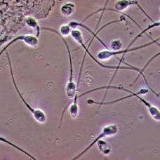 Как женский организм отбирает самые быстрые сперматозоиды