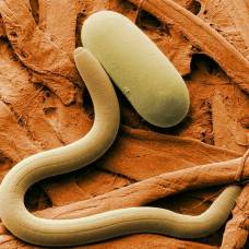 Найдены бактерии, пожирающие опасных паразитических червей изнутри