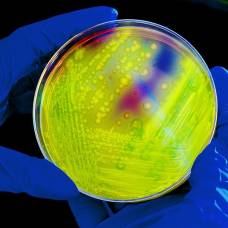 Как быстро микробы погибают от ультрафиолета?