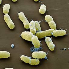 Сколько бактерий или единиц вируса нужно для развития заболевания?